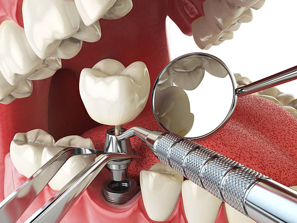 Best Tooth Pain Emergency Relief  in Woodburn, IN